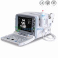 Ysb2000g Medical Full Digital Portable Ultrasound Machine